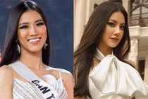 Gương mặt khác lạ nghi dao kéo của Á hậu Kim Duyên