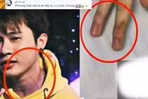 Rộ nghi vấn Jack bị hành hung, K-ICM nhắn tin đe dọa