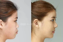 Người có 3 nét tướng này, cô đơn cả đời, nghèo mạt kiếp