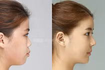 Người có 3 nét tướng này, cô đơn cả đời, nghèo mạt kiếp