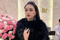 Gương mặt lạ hoắc của Lâm Khánh Chi: Nghi vấn dao kéo quá đà?