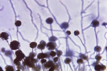 Điều gì xảy ra nếu thế giới gặp phải "đại dịch nấm"?