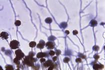 Điều gì xảy ra nếu thế giới gặp phải "đại dịch nấm"?