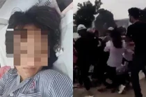 Video: Nữ sinh bị đánh hội đồng chấn thương đầu ở Quảng Ninh