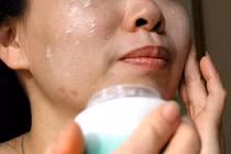 Mụn nổi chi chít vì ham hố bôi kem collagen