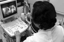 U nang buồng trứng type IB có phải là ung thư?