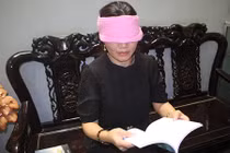 Sự thật choáng về quý bà ''siêu nhân 3 mắt'' ở Hòa Bình