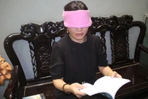 Sự thật choáng về quý bà ''siêu nhân 3 mắt'' ở Hòa Bình