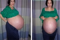 Giải mã chuyện người phụ nữ 30 năm đẻ 69 người con