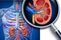 8 bất thường ở thận rất nguy hiểm mà bạn nên biết