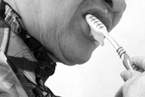 Hỏng cả lợi vì bàn chải đánh răng 2000 đồng