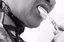 Hỏng cả lợi vì bàn chải đánh răng 2000 đồng