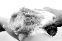 Hỏng da vì dùng xơ mướp làm đẹp