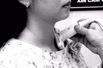 Lý do không nên chủ quan với bệnh bướu cổ 