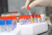 Có thể dùng nước tiểu chữa bệnh phụ khoa? 