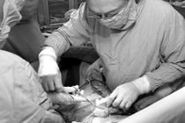 Ung thư cổ tử cung nên mổ hay hóa, xạ trị? 