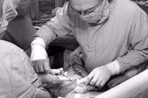 Ung thư cổ tử cung nên mổ hay hóa, xạ trị? 