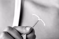 Thời điểm tốt nhất để tháo vòng tránh thai