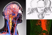 Bác sĩ Việt Nam nói về tính khả thi của ca ghép đầu người