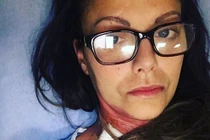 Làm nail... nữ y tá mất chân, suýt chết vì điều không ngờ