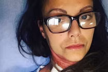 Làm nail... nữ y tá mất chân, suýt chết vì điều không ngờ