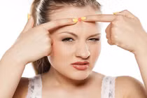 Mụn xuất hiện chi chít trên trán, đây là nguyên nhân!