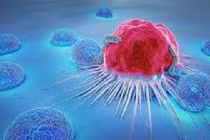 4 bệnh vặt không chữa sớm dễ chuyển thành ung thư