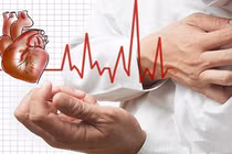 Coi bóng đè là mê tín, người phụ nữ suýt chết vì đột quỵ