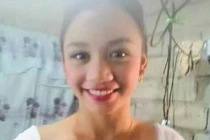 Sai lầm nặn mụn, gái xinh mù lòa, đau đớn sống không bằng chết