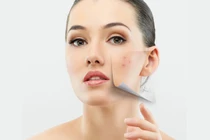 8 công thức mặt nạ trị khuyết điểm để da đẹp không tì vết