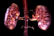 Sai lầm triệu người người mắc, hại thận không thể cứu vãn