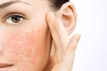 Tẩy da chết sai cách, hại đến mức này không phải ai cũng biết