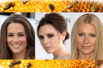 Làm đẹp bằng nọc ong như Công nương Kate có hiệu quả