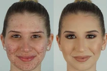 Xem phù thủy trang điểm hô biến mặt mụn thành mặt mịn