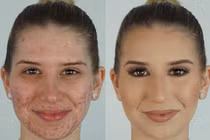 Xem phù thủy trang điểm hô biến mặt mụn thành mặt mịn