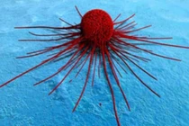 Khám phá quá trình di căn của tế bào ung thư