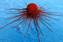 Khám phá quá trình di căn của tế bào ung thư