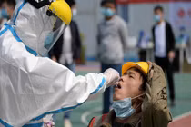 Chi tiết về ca nhiễm COVID-19 đầu tiên trên thế giới ở Vũ Hán