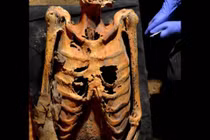 Rợn người thần dược làm từ cơ thể người thời cổ đại