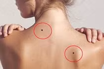 Vị trí nốt ruồi số khổ, bước ra cửa là gặp thị phi