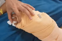 Nạn nhân bị chém lìa tay kể lại giây phút bị truy sát trên phố Sài Gòn