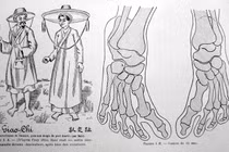 Sự thật về “bàn chân Giao Chỉ” của người Việt cổ