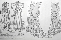 Sự thật về “bàn chân Giao Chỉ” của người Việt cổ