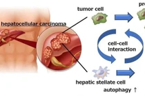 Tìm ra phương thức mới để ngăn ngừa ung thư gan