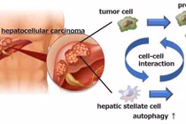 Tìm ra phương thức mới để ngăn ngừa ung thư gan