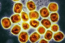 Virus đậu mùa khỉ đang đột biến