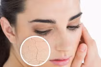 Dấu hiệu cảnh báo da lão hóa sớm bạn phải biết 