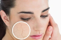 Dấu hiệu cảnh báo da lão hóa sớm bạn phải biết 