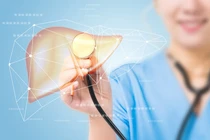 Cảnh báo tổn thương gan nghiêm trọng từ 6 bộ phận bị sưng tấy