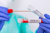 Ngày 17/9, ghi nhận 2.479 ca mắc mới, thêm ca tử vong vì COVID-19